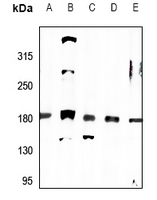 1 - Anti-MRCK alpha Antibody AP51062