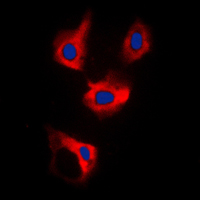 3 - Anti-CDCA3 Antibody AP51063
