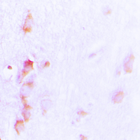 19 - Anti-CDCA3 Antibody AP51063