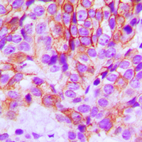 19 - Anti-E Cadherin Antibody AP51064