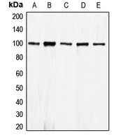 1 - Anti-E Cadherin Antibody AP51064