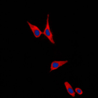 3 - Anti-E Cadherin Antibody AP51065