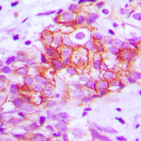 19 - Anti-E Cadherin Antibody AP51065