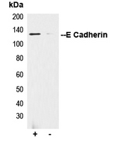 5 - Anti-E Cadherin Antibody AP51065