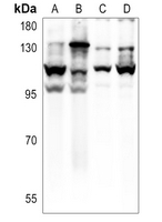 1 - Anti-E Cadherin Antibody AP51065