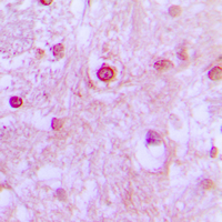 19 - Anti-CDK10 Antibody AP51068