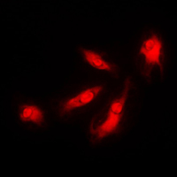 3 - Anti-CDK5R1 p35 Antibody AP51069