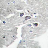 19 - Anti-CDK5R1 p35 Antibody AP51069