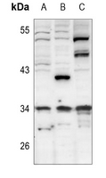 1 - Anti-CDK5R1 p35 Antibody AP51069