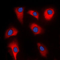 3 - Anti-p39 Antibody AP51070