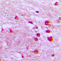 19 - Anti-p39 Antibody AP51070