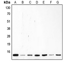 1 - Anti-p14 ARF Antibody AP51072