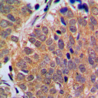 19 - Anti-p18 INK4c Antibody AP51074