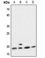 1 - Anti-p18 INK4c Antibody AP51074
