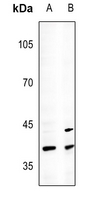 1 - Anti-CDX2 Antibody AP51075