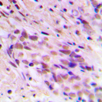 19 - Anti-CDYL2 Antibody AP51076