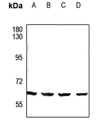 1 - Anti-CDYL2 Antibody AP51076