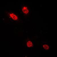 3 - Anti-C/EBP delta/epsilon Antibody AP51077