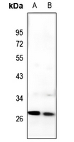 1 - Anti-C/EBP delta/epsilon Antibody AP51077