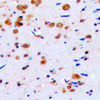 19 - Anti-CUGBP1 Antibody AP51078