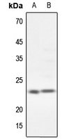 1 - Anti-CG beta Antibody AP51081