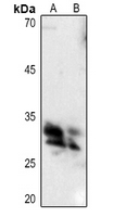 1 - Anti-Hydrophobestin Antibody AP51082