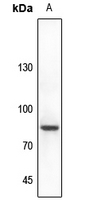 1 - Anti-CHAT Antibody AP51084