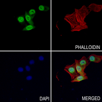 3 - Anti-CHD1L Antibody AP51085