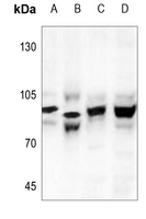 1 - Anti-CHD1L Antibody AP51085