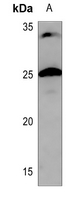 1 - Anti-CHP2 Antibody AP51087