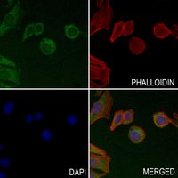 3 - Anti-CLCN6 Antibody AP51091