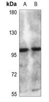 1 - Anti-CLCN6 Antibody AP51091