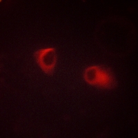 3 - Anti-Claudin 10 Antibody AP51092