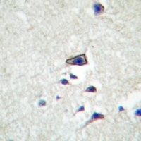 19 - Anti-Claudin 10 Antibody AP51092