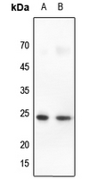 1 - Anti-Claudin 10 Antibody AP51092