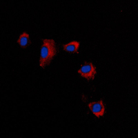 3 - Anti-Claudin 2 Antibody AP51093