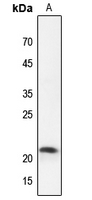 1 - Anti-Claudin 4 Antibody AP51094
