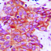 19 - Anti-Claudin 5 Antibody AP51095