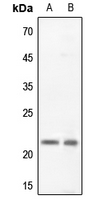 1 - Anti-Claudin 5 Antibody AP51095