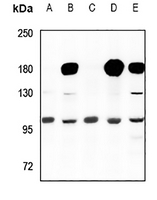 1 - Anti-Cyclin M2 Antibody AP51098