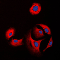 3 - Anti-Collagen 11 alpha 1 Antibody AP51099