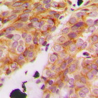 19 - Anti-Collagen 11 alpha 1 Antibody AP51099