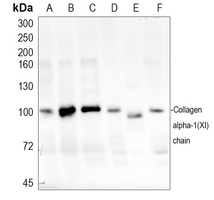 1 - Anti-Collagen 11 alpha 1 Antibody AP51099