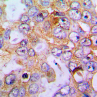 19 - Anti-Collagen 18 alpha 1 Antibody AP51100