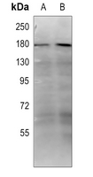 1 - Anti-Collagen 18 alpha 1 Antibody AP51100