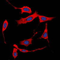 3 - Anti-Collagen 1 alpha 2 Antibody AP51101