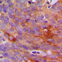19 - Anti-Collagen 1 alpha 2 Antibody AP51101