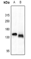 1 - Anti-Collagen 1 alpha 2 Antibody AP51101