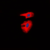 3 - Anti-Collagen 1 alpha 2 Antibody AP51102