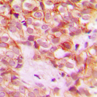 19 - Anti-Collagen 1 alpha 2 Antibody AP51102